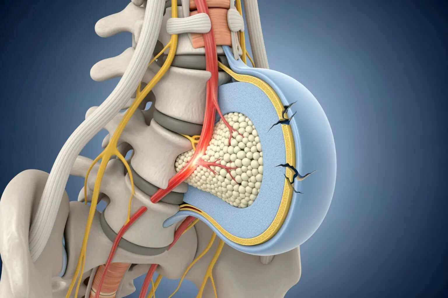 Everything-You-Need-to-Know-About-Sciatic-Nerve Neuropasil 2077199