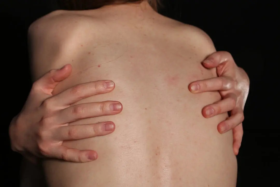 Sciatica Relief: Simple Strategies for Soothing Nerve Pain