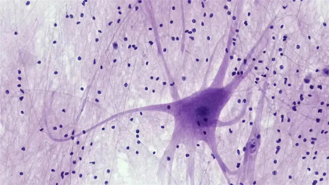 The Complete Guide to Neuropathy Basics