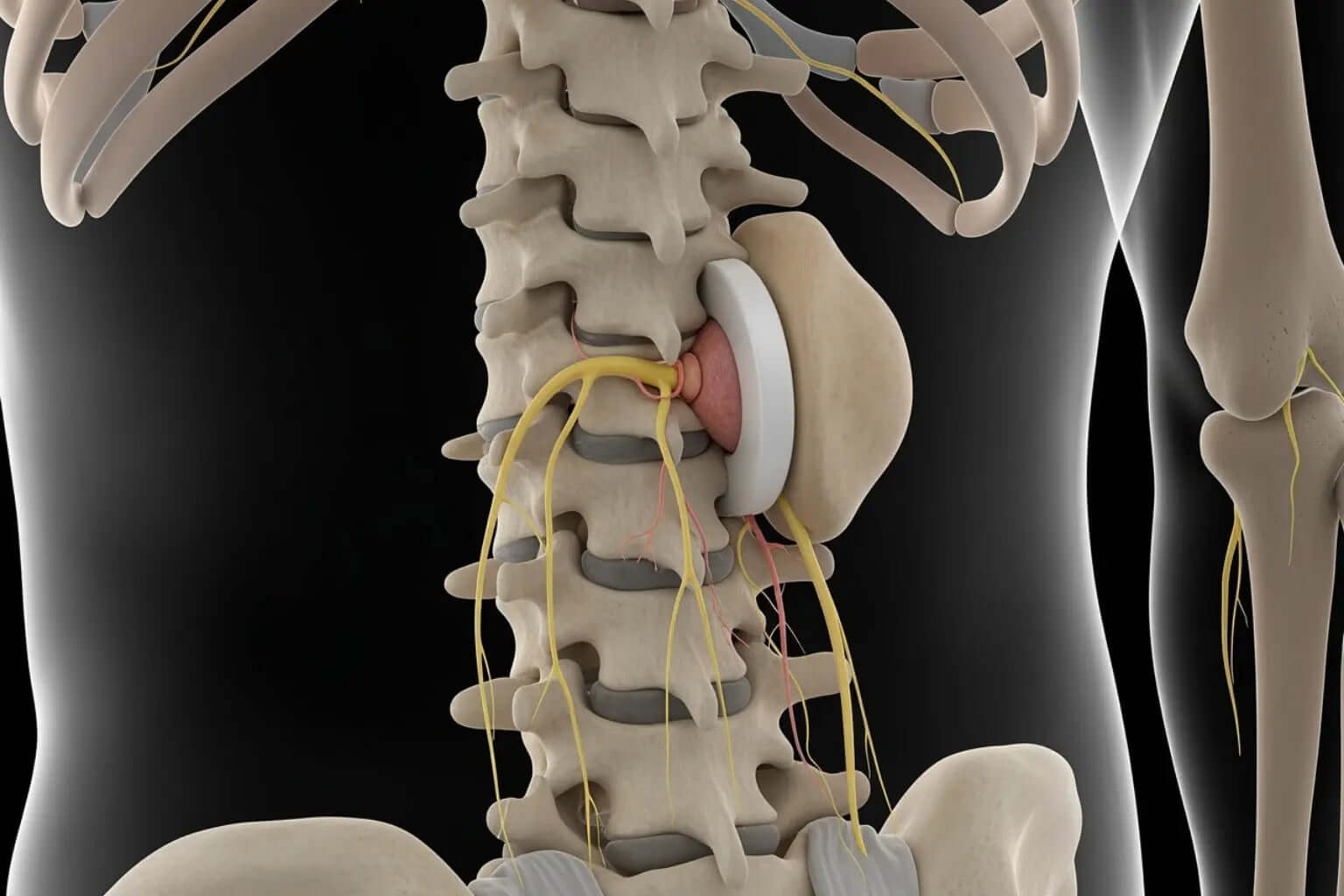 Freedom from the Squeeze: How to Relieve a Pinched Nerve