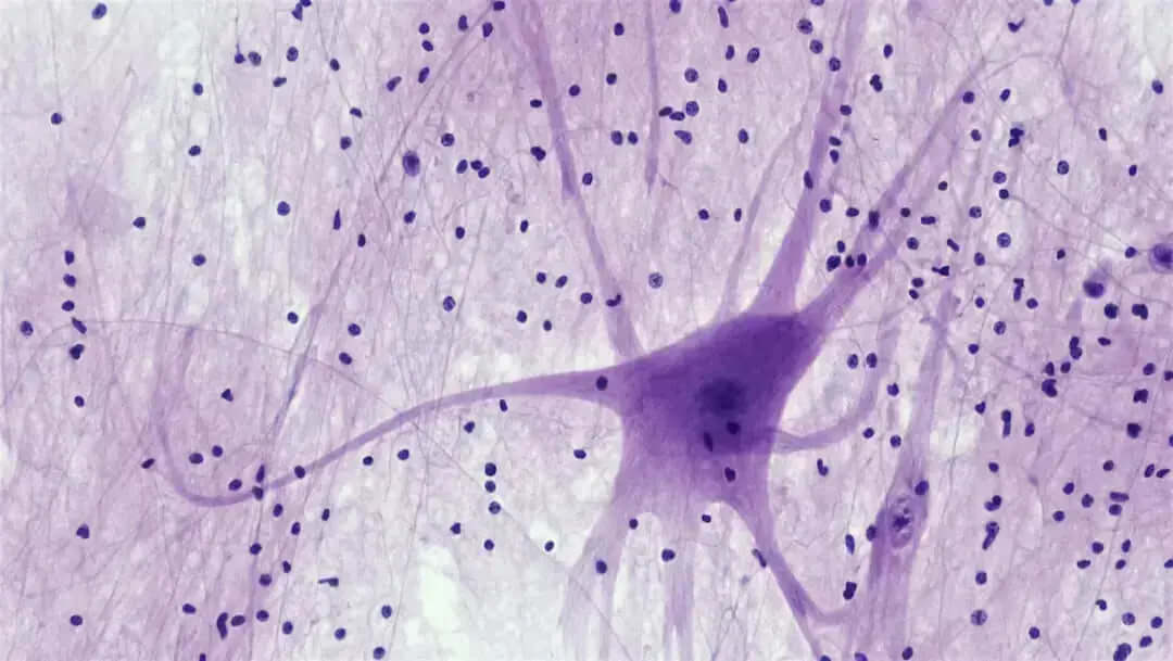 The Complete Guide to Neuropathy Basics