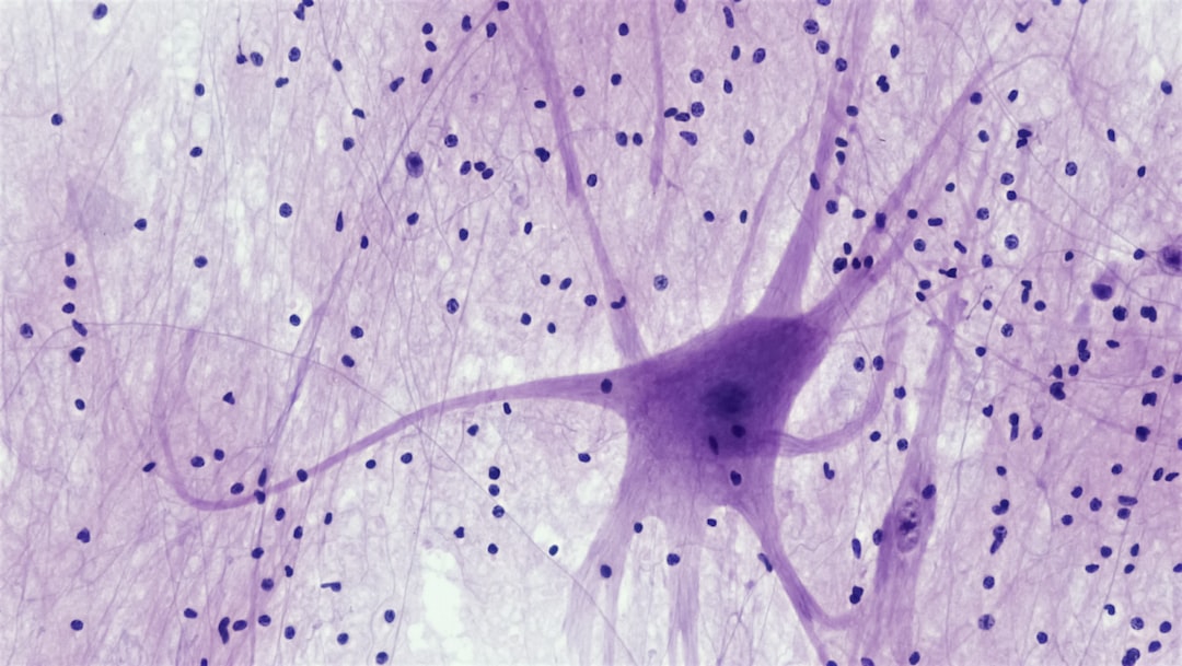 The Complete Guide to Neuropathy Basics